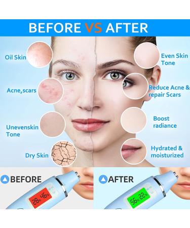 Hyaluronic Acid Jelly Mask Powder | Professional Peel Off Rubber Mask for Brightening & Hydrating | Includes Double-ended Silicone Brush | 23 Fl Oz - Buy Online on GoSupps.com