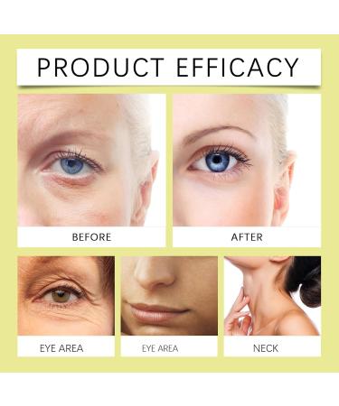 Retinal Shot Tightening Booster Retinal Shot Creme Retinol Visage Retinol Serum pour Visage & Yeux R duit les rides et les ridules une peau plus ferme Hydratation longue dur e (15g 3pc) 3pc 15 g (Lot de 1) - Buy Online on GoSupps.com