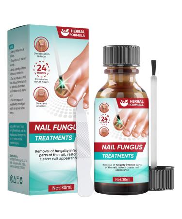 Nail Fungus Treatment for Toenail Fungal Nail Treatment Extra Strong Toe Nail Repair Kit for Thick Damaged Discolored Nails 30ML 30 ml (Pack of 1)