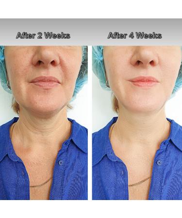 Rodan and Fields Micro-Dermabrasion Paste - Gentle Face & Body Scrub | Exfoliate for Brighter Vibrant Skin - 125 mL/4.2 Fl. Oz - International Shipping Available - Buy Online on GoSupps.com