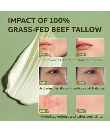 LOPIANY Beef Tallow for Skin Beef Tallow and Honey Balm All-Natural Face Body Moisturizer Nourishes and Hydrates the Skin Grass Fed Whipped Balm Infused with Raw Wild Honey 2oz - Buy Online on GoSupps.com