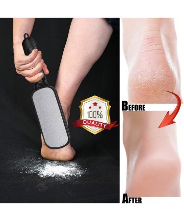 Foot File Callus Remover | Double Sided Scrubber for Dead Skin | Pedicure Tool for Hard Skin, Callus, Plantar Wart, Corn | Skin-Friendly Metal Foot File - Buy Online on GoSupps.com