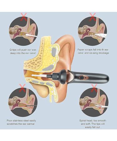 Ear Wax Removal Vacuum - Gentle Spiral Ear Cleaning Tool for Adults & Children | Black Ear Suction Device - Buy Online on GoSupps.com