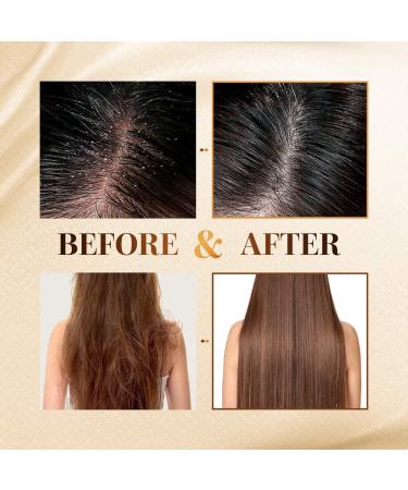 CP-1 Ginger Purifying Conditioner 100 ml Conditioner Resolve Nutritional Deficiencies Tired Hair Treatment Ginger Oil Improves Makes Hair Healthy and Shiny - Buy Online on GoSupps.com