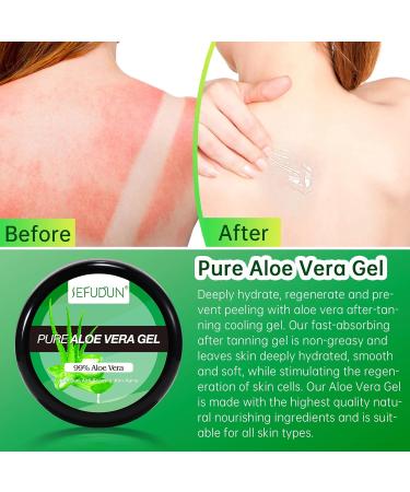 Aloe Vera Gel Organic Aloe Vera Gel Natural Aloe Vera Gel Moisturizing Soothing and Moisturizing Repairing Sunburn and Scars Face Care Body Hair 50 g - Buy Online on GoSupps.com