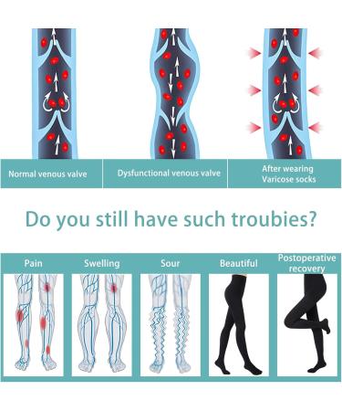 Evolyline 20-30mmHg Medical Compression Tights for Men & Women - Class II Closed Toe Lipedema Support in Black - International Shipping Available - Buy Online on GoSupps.com