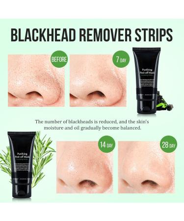 Blackhead Remover for Face & Nose - Deep Cleansing Pore Treatment for All Skin Types | Acne Solution for Men & Women - Buy Online on GoSupps.com