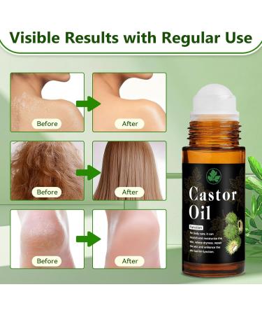 Organic Castor Oil Roll On 30ml (1 fl. oz) Pure Cold Pressed Roll On Castor Oil Organic Castor Oil Roller Ball for Skin Scalp Neck Hands Joints Waist & Belly Moisturizing Care - Buy Online on GoSupps.com