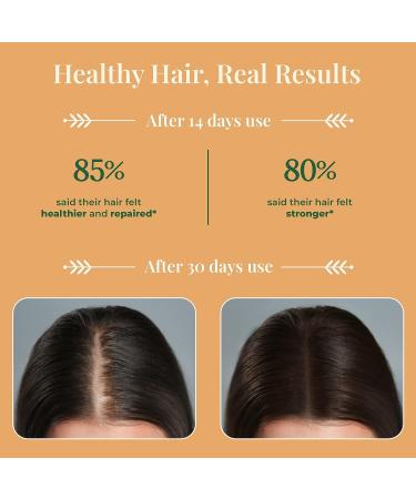 Amla Hair Oil by Asna - 100% Cold-Pressed Organic Hair Growth Treatment for All Hair Types | Stimulates Natural Growth, Nourishes Scalp, Ayurvedic Blend of Vitamin C and Antioxidants - Buy Online on GoSupps.com