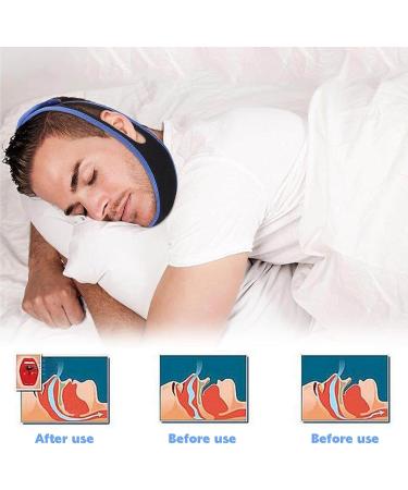 3PCS Adjustable Anti Snoring Chin Strap - Effective Snoring Solution for Men and Women - Buy Online on GoSupps.com