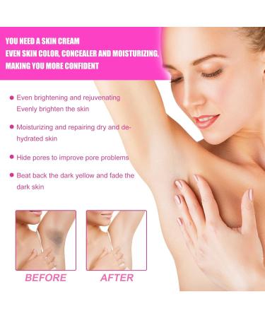 Skin Whitening Cream | Armpit & Underarm Lightening | Dark Spot Corrector for Body | 2oz Intimate Area Bleaching Solution - Buy Online on GoSupps.com