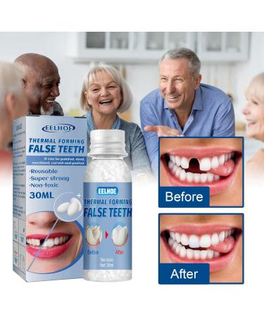 Temporary Tooth Filling Kit for Missing or Broken Tooth Repair | Moldable False Teeth Replacement Solution - Buy Online on GoSupps.com