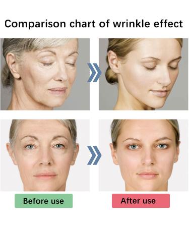 5 Seconds Wrinkle Remover 5 Seconds Retinol Anti-Wrinkle Cream 5 Seconds Anti Wrinkle Face Cream Instant Wrinkle Remover Lifting Moisturizing Facial Cream Tightening Face Cream or Women - Buy Online on GoSupps.com