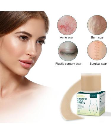 Silicone Scar Patch Roll - Professional Scar Removal Tape for Surgery, Burns, Keloid - 1.6 x 120 Roll - Buy Online on GoSupps.com
