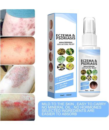 Yanolam Meellop Herbal Psoriasis Relief Spray - Soothes and Moisturizes, Stops Itching & Burning - 3 pc Eczema Relief Set - Buy Online on GoSupps.com
