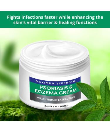 Hermon Psoriasis Eczema Relief Cream: Maximum Strength for Psoriasis Eczema - Relieve Symptom of Resistant Effective for Seborrheic Dermatitis Folliculitis 100m 3.4 Fl Oz (Pack of 1) - Buy Online on GoSupps.com