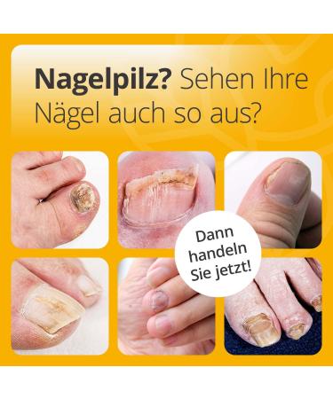 Nail Oil Repair & Protect + Foot Bath Salt + Wash Lotion Set - Effective Foot & Nail Fungus Treatment with Natural Oils - International Shipping Available - Buy Online on GoSupps.com