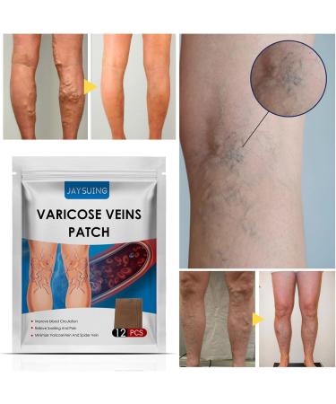 XIYINLI 12pcs Varicose Veins Patches | Skin-Friendly & Non-Toxic Relief for Swelling & Pain - Buy Online on GoSupps.com