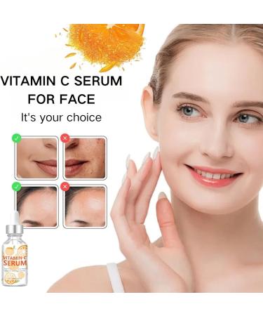 Tongyend Vitamin C Serum For Face Dark Spot Remover Facial Serum Vitamin C Serum With Hyaluronic Acid Retinol Niacinamide Anti Aging Face Serum for Smooth Fine Lines&Wrinkles &n Brighten - Buy Online on GoSupps.com