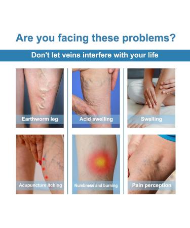 Shantou Youjia Variant Veins Spray Cream against spider veins and vein care fade cream spray against spider vein for radiant skin Skin Revealing and Care for Varicose Veins Location care spray 30 ml - Buy Online on GoSupps.com