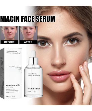 50ml Facial Nicotinamide Serum Nicotinamide Hydrating Serum Spots Removal Minimizing Pores Nicotinamide Brightening - Buy Online on GoSupps.com