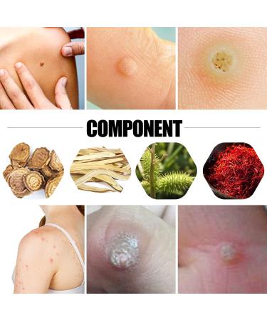 Coniya 12pcs Corn Removal Patch - Effective Square Shape Skin Restore with Active Ingredients for Smoother Feet | International Shipping - Buy Online on GoSupps.com