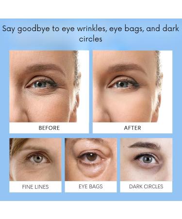  Nuvilo Instant Firmx 6% Caffeine Eye Cream for Dark Circles & Puffining Retinol & Hyaluronic Acid Under Eyes Anti Aging Care for Wrinkles & Fine Lines - 6 Pack - Buy Online on GoSupps.com