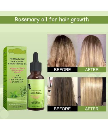 Rosemary Oil for Hair Growth - Essential Oil & Scalp Treatment for Men & Women | Nourishes & Reduces Hair Loss - 59ML - Buy Online on GoSupps.com