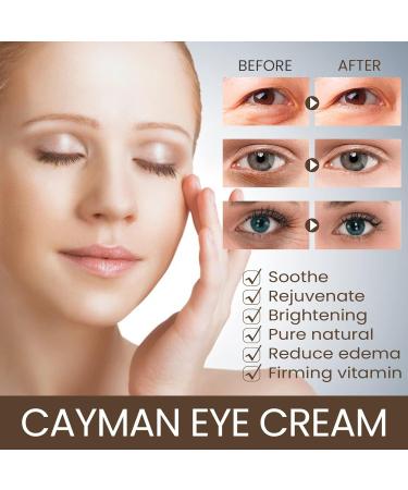 Collagen Retinol Under Eye Cream | Anti-Aging Solution for Dark Circles & Puffiness | Smooth Fine Lines - 0.7 oz - Buy Online on GoSupps.com