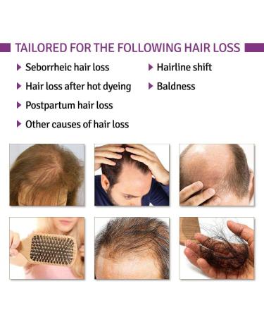 DISAAR BEAUTY Natural Hair Growth Serum - Ginger Essential Oil Treatment for Strong, Thick Hair - Anti Hair Loss & Baldness Solution - Buy Online on GoSupps.com