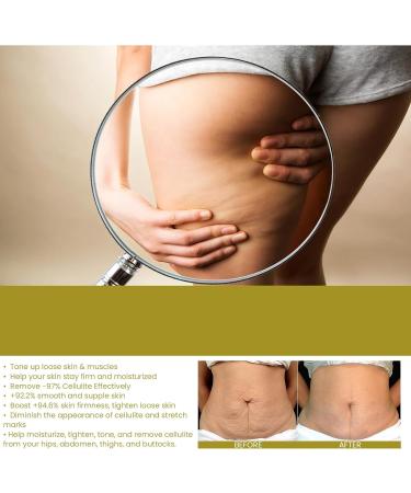 Collagen Fibrillar Oil Compact Body Oil Skin Lifting Body Oil Beauty Women Collagen Lifting Body Oil Collagen Oil For Skin Tightening Body Treatment Oil Natural Body Oil - Buy Online on GoSupps.com