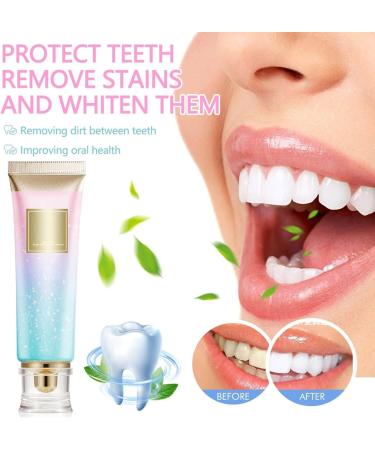 Niacinamide Whitening Toothpaste with Niacinamide 100 g Niacinamide Whitening Toothpaste Teeth Whitening Toothpaste Stain Removal and Whitening - Buy Online on GoSupps.com