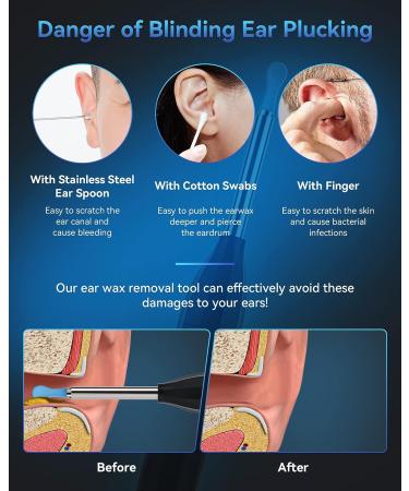 TopWigy Ear Wax Removal Tool with 1440P Camera, 6 LED Lights & 6 Spoons - Waterproof 5MP HD Ear Otoscope for iOS & Android - Black - Buy Online on GoSupps.com