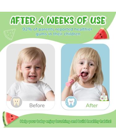 Fluoride-Free Baby Toothpaste for Ages 2-3 Natural Fruit-Flavored Mild Formula Pea-Sized Amount for Developing Teeth 2.1 oz (60g) (1 Pack Watermelon) Watermelon 1 - Buy Online on GoSupps.com