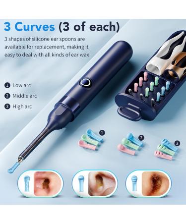 Ear Wax Removal Ear Cleaner with Camera 1296P HD Visual Ear Cleaner with 6 LED Lights and Flexible Tip FSA HSA Eligible Items Safe Ear Wax Removal Kit with Camera Ear Cleaning Tool for Family Gifts Black - Buy Online on GoSupps.com