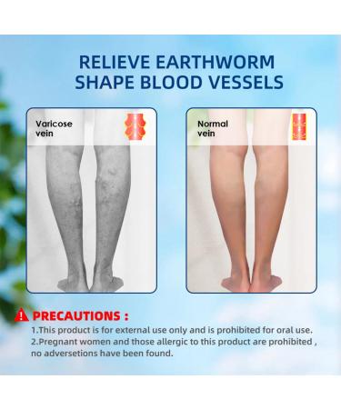  MagiSel Varicose Vein Cream Cream Against Spider Veins Varicose Vein Leg Care Cream 20g Spider Vein Varicose Vein Cream for Legs Eliminates Varicose Veins and Spider Veins - Buy Online on GoSupps.com