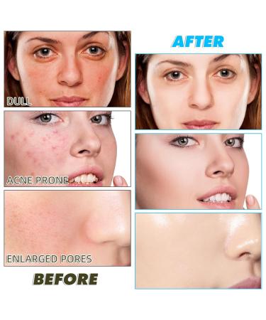 Turmeric Kojic Acid Pads - 60 Exfoliating Cleansing Pads for Dark Spots - Suitable for All Skin Types - Buy Online on GoSupps.com