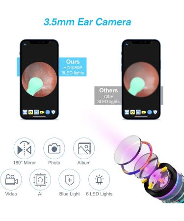 Blumway WiFi Ear Otoscope 3.5mm 1080p HD Camera - Ear Cleaner & Wax Removal Tool for Babies Children & Adults - iOS & Android Compatible - Gray - Buy Online on GoSupps.com
