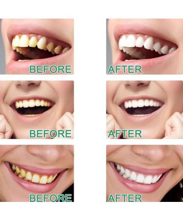 4Pcs Vous Toothpaste Glamcor Whitening Toothpaste Glamvora Triple Whitening Niacinamide Toothpaste Fresh Breath Remove Tooth Stains (Probiotic) 1 Count (Pack of 4) - Buy Online on GoSupps.com