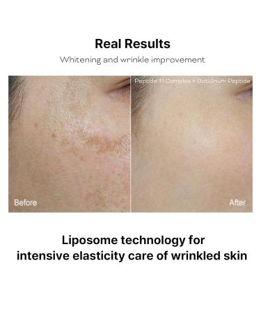 Buy Peptide 11 Botulinum Multi Recovery Ampoule 30ml - Anti-Aging Skin Treatment for Global Shipping - Buy Online on GoSupps.com