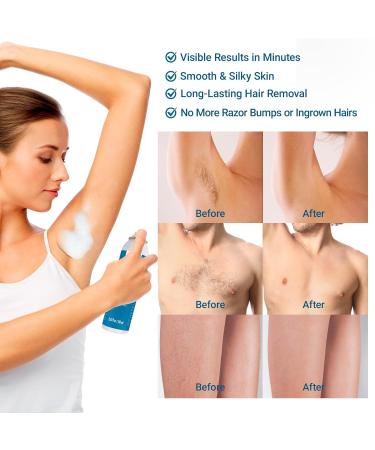 Hair Removal Spray Foam - 100% Natural Formula Painless & Effective Depilatory Cream for Body & Intimate Areas - Suitable for Women & Men - Buy Online on GoSupps.com