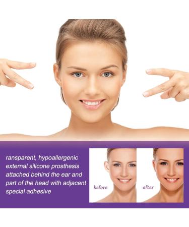 Ear Patch Corrector - 12PCS for Children 3+ - Cosmetic Ear Correction Stickers for Protruding Ears - Auricle Valgus Correction - Buy Online on GoSupps.com