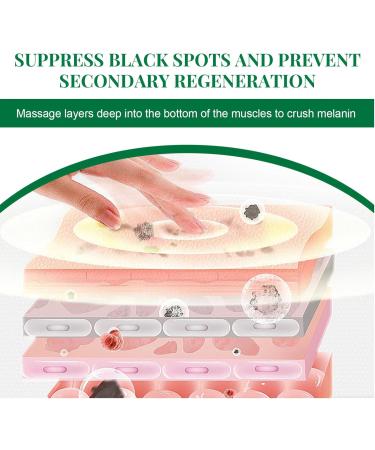  Nuvilo Dark Spot Correcting Glow Niacinamide Serum Face Serum for Dark Spots Brightening Skin Care for Hyperpigmentation Anti-Aging Moisturizer (4 Pieces) - Buy Online on GoSupps.com