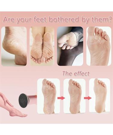 Foot Polisher Electric Dermave Electric Foot Callus Remover Callus Remover for Feet Electric 2024 New Foot Electric File with 60PCS Sanding Discs For Dead Dry Crack Calluses(Black) - Buy Online on GoSupps.com