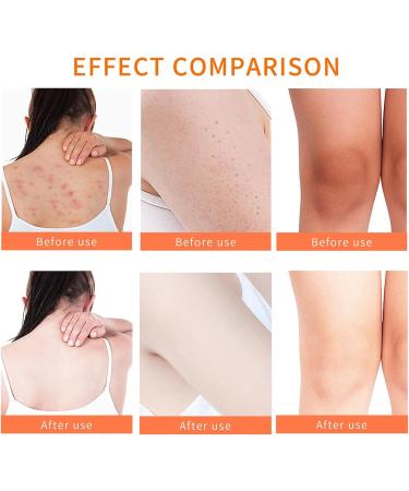 Turmeric Body Scrub - Turmeric Exfoliating Body Scrub Face Scrub - Boost Remove Dark Spot Age Spots Acne Hyperpigmentation - Turmeric Scrub for Firm Hydrated Skin - Great Gifts For Women Turmeric 300g - Buy Online on GoSupps.com