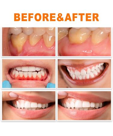 Lenaro Oral Repair Treatment Ampoules - Gum Repair Solution (21 Pieces/3 Boxes) - Fast International Shipping - Buy Online on GoSupps.com