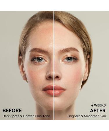 Dark Spot Remover for Face and Body Age Spot Sun Spot Freckles Remedy Corrector Serum 360 Roller Applicator with Vitamin C and Glutathione 0.6 Fl Oz - Buy Online on GoSupps.com