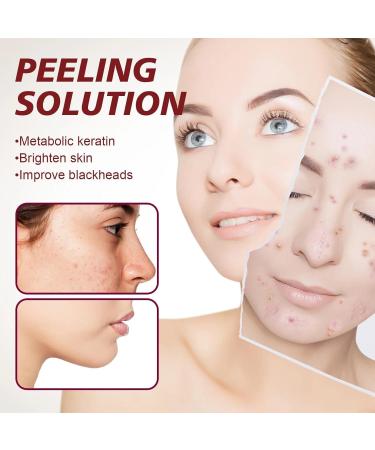 AHA 30% + BHA 2% Peeling Solution Glycolic Acid Peel with Aloe Vera for Large Pores Wrinkles & Fine Lines Chemical Peel for Face at Home 1.0 Floz - Buy Online on GoSupps.com