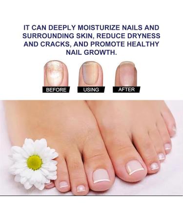 Soin des ongles l'acide hyaluronique avec vitamine E et huile de jojoba traitement hydratant intense pour des ongles forts et hydrat s favorise une croissance saine (3 Pcs) - Buy Online on GoSupps.com