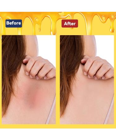 Fast Acting Drawing Salve Cream for Eczema Relief - Moisturizer for Itchy Skin Suitable for Adults & Children - Buy Online on GoSupps.com